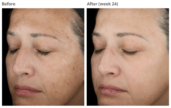 TNS Essential Serum MustHave of the Month Comprehensive Dermatology