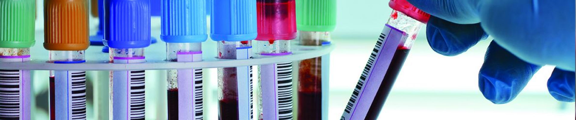 Using a Laboratory Barcode System for Automation Comp Pro Med