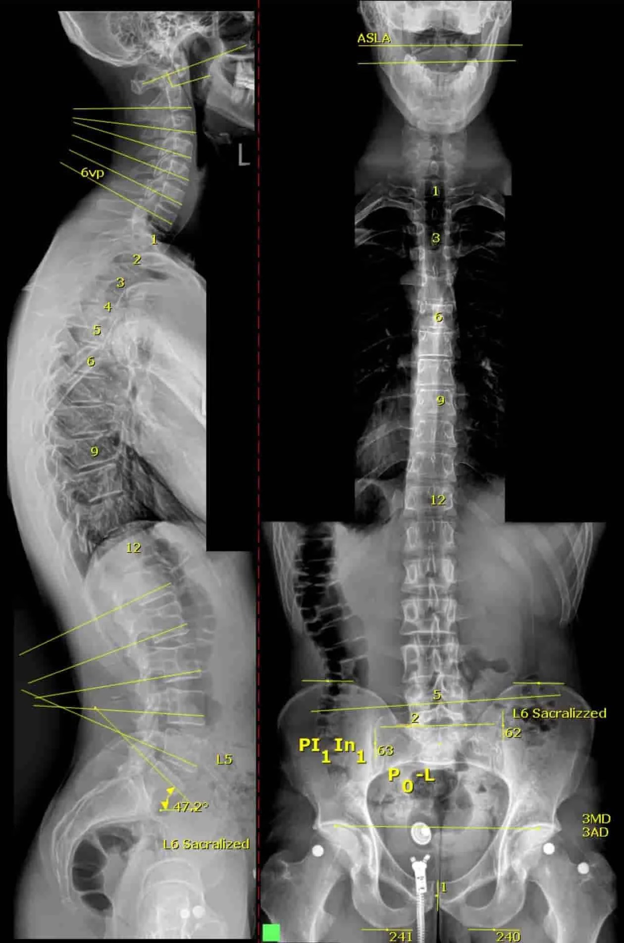 Neck Strengthening Exercises 10 Easy To Do Exercises At Home