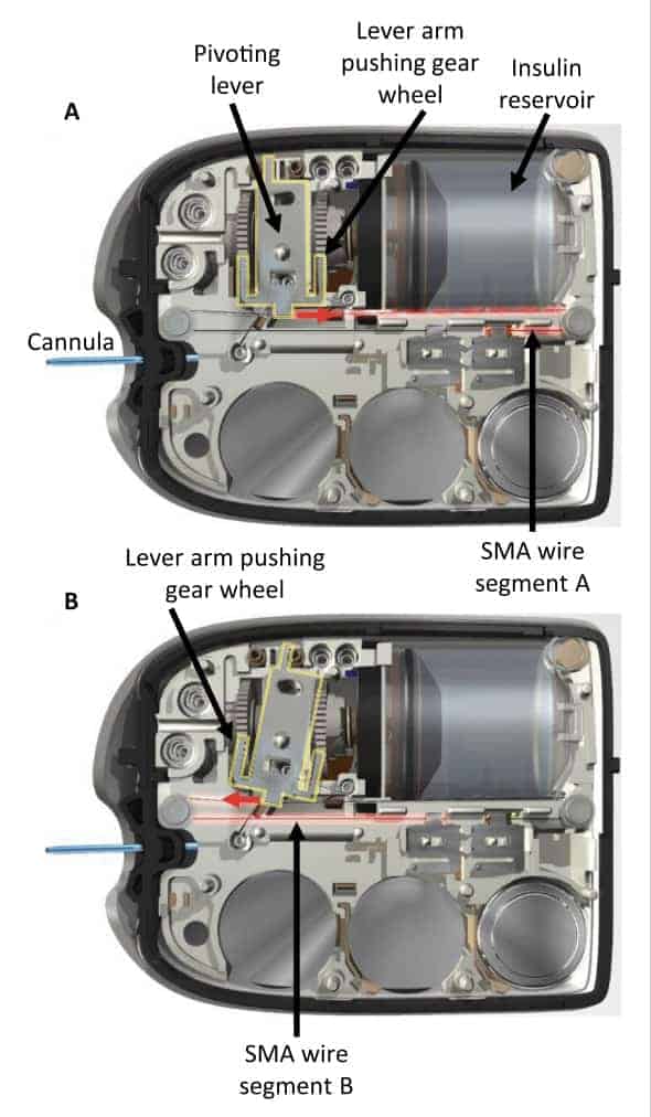 How Does an Omnipod Insulin Pump Actually Work
