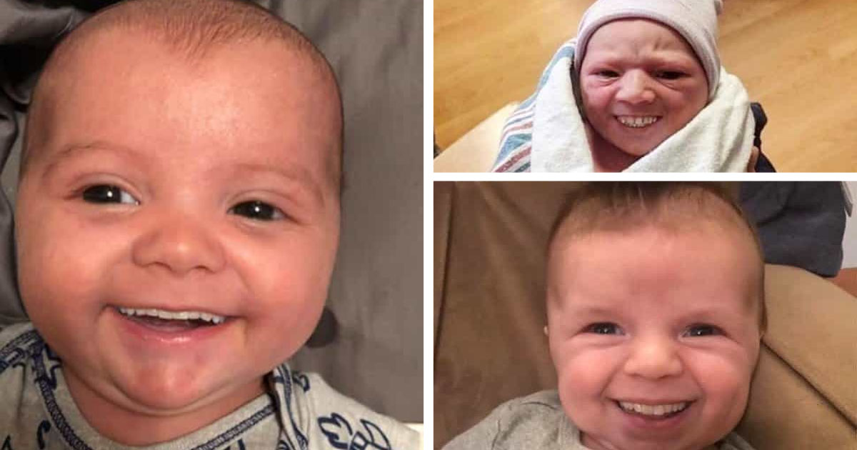 20 bébés qui se sont faits des dents d'adulte
