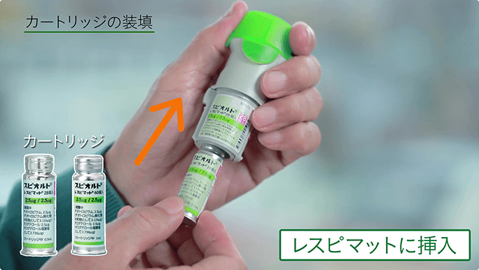 ひどい Copd 治療 スピリーバ 歯型が目
