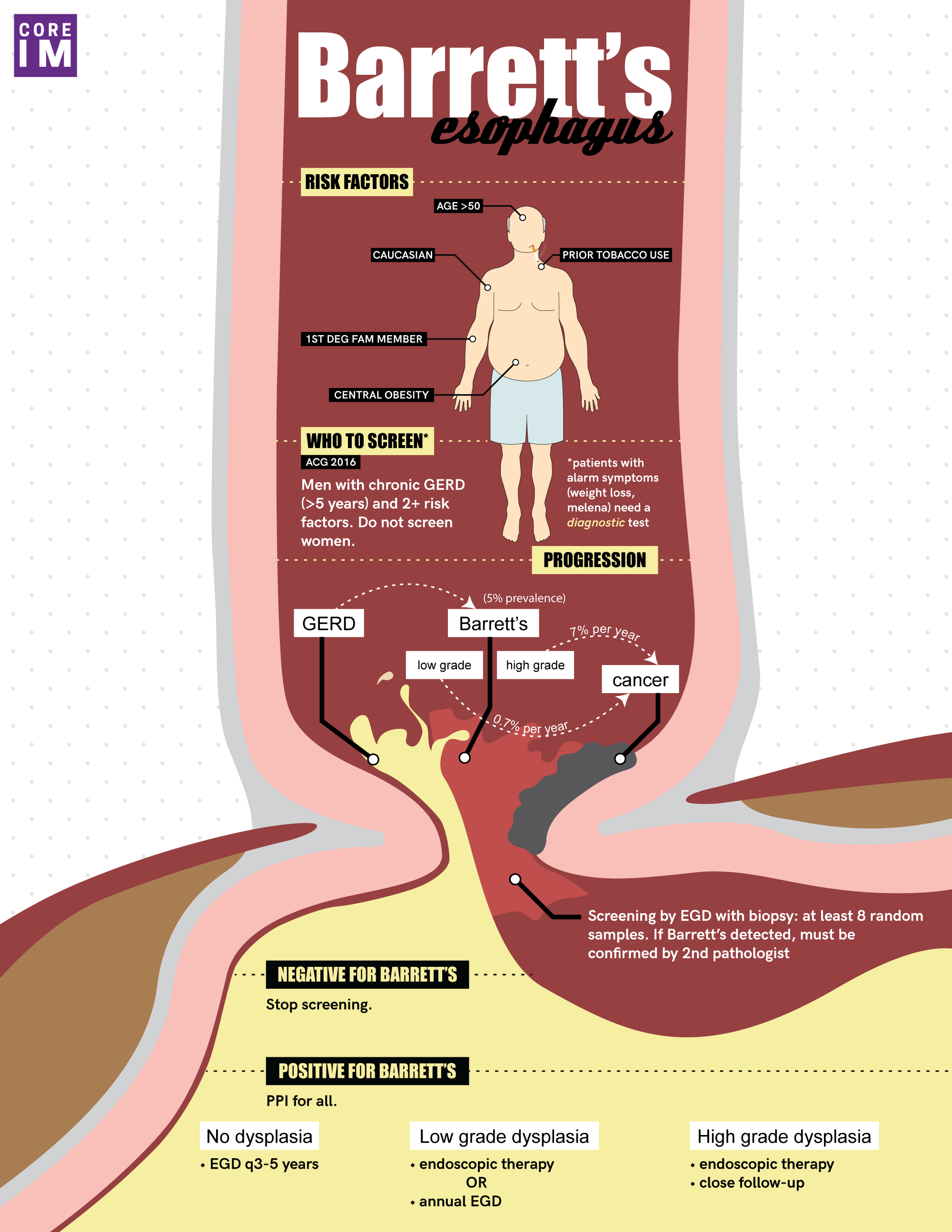 Does Barretts Esophagus Lead To Cancer CancerWalls