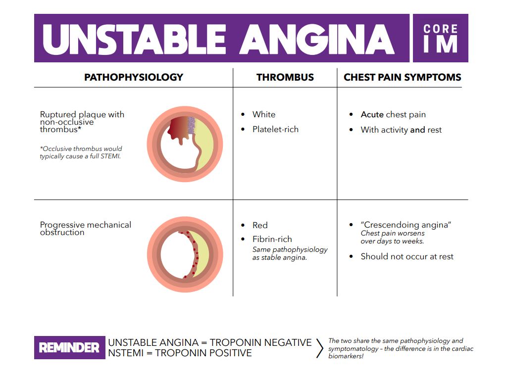 Unstable Angina Core IM Podcast