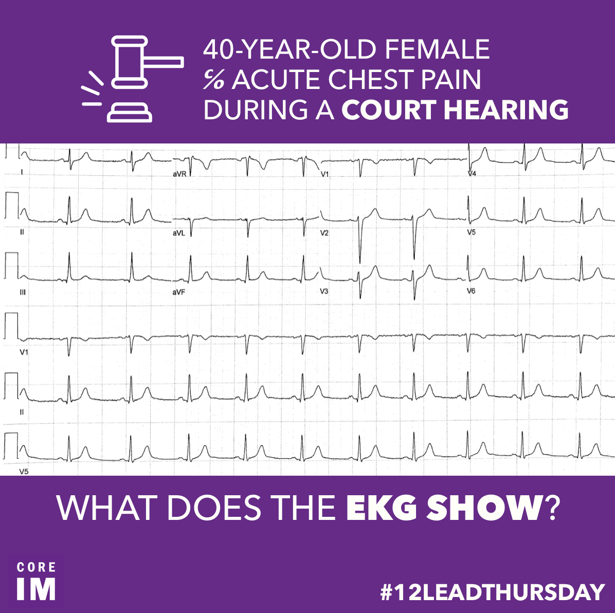 40yearold female c/o acute chest pain... Core IM Podcast