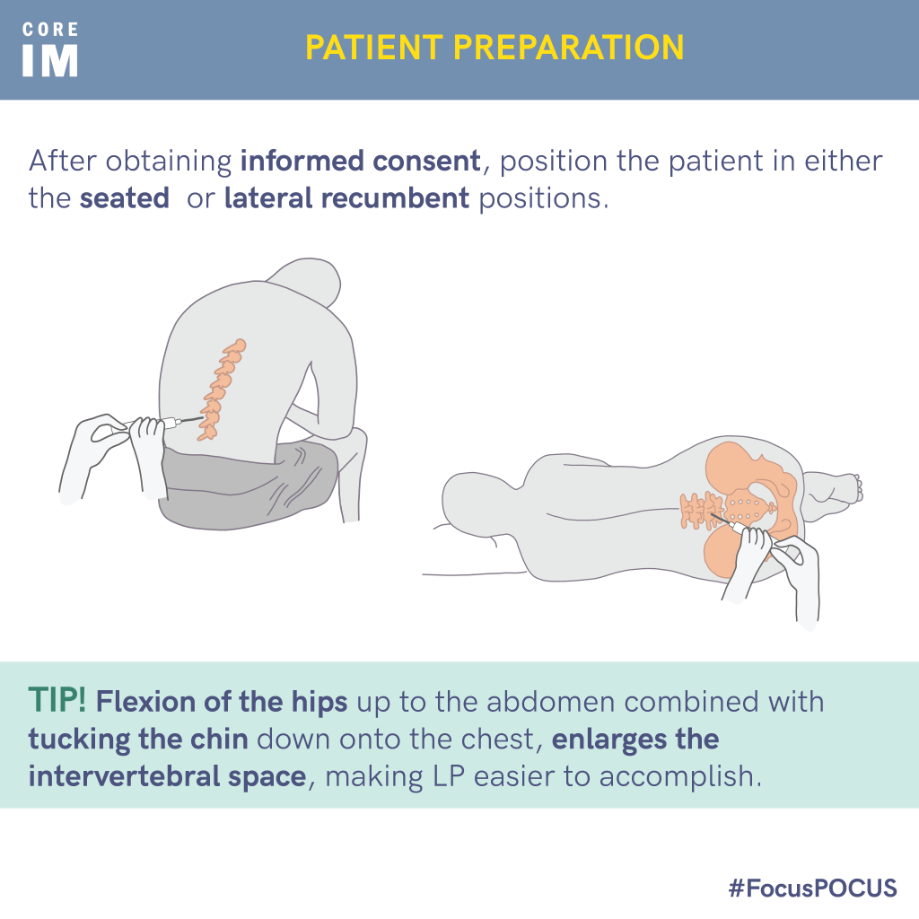POCUSguided Lumbar Puncture Core IM Podcast