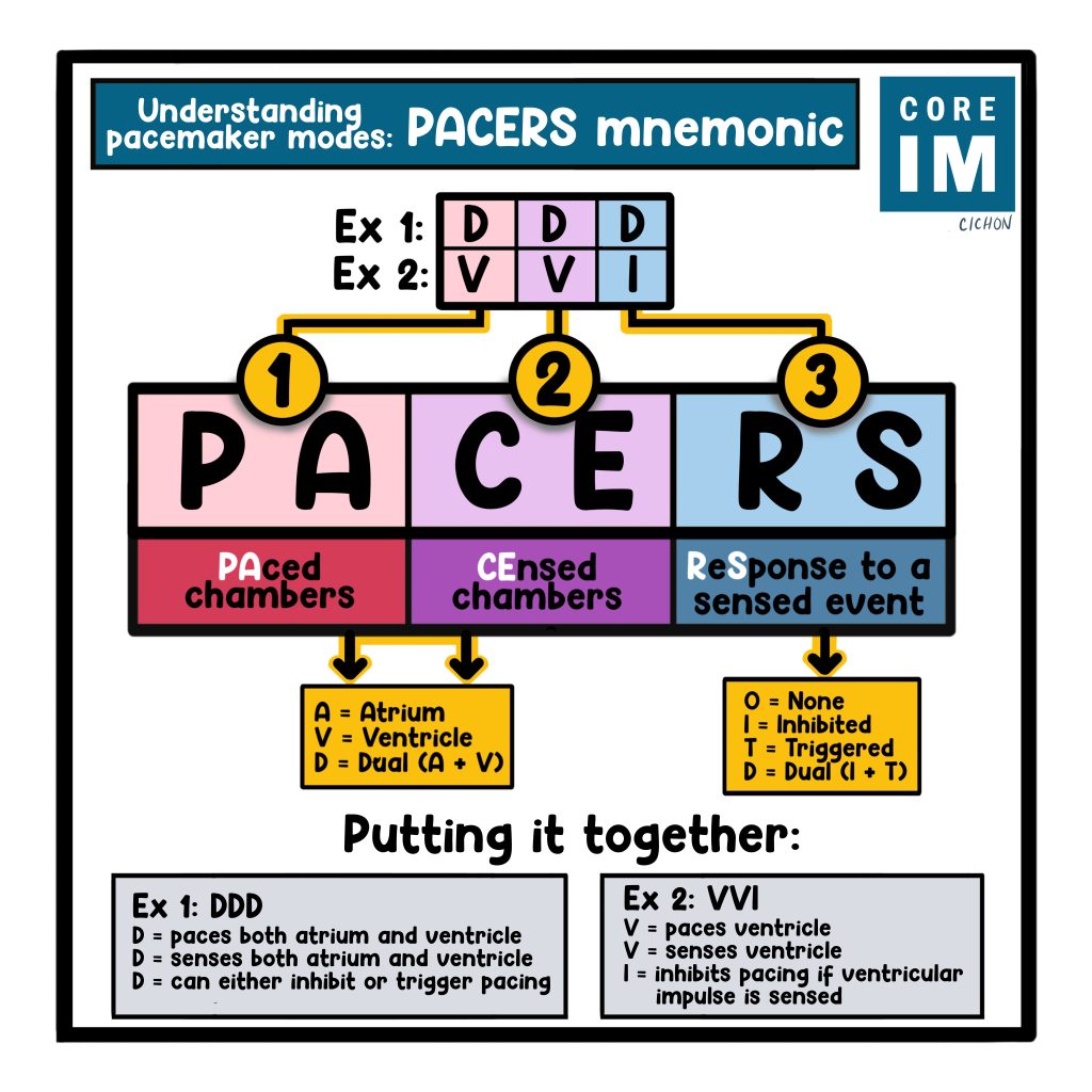 Pacemakers & ICDs 5 Pearls Segment Core IM Podcast
