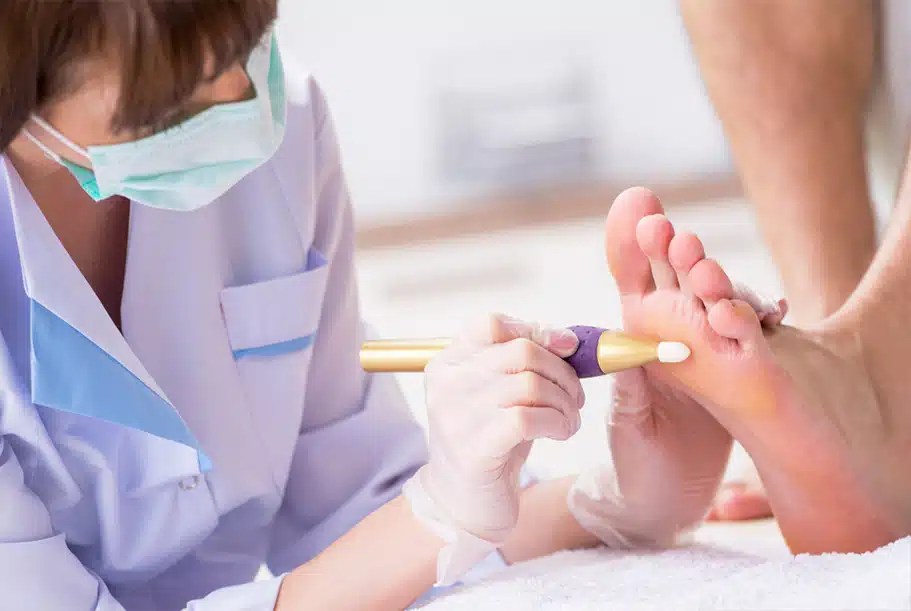 Corn Surgery Recovery Get Back on Your Feet in No Time!