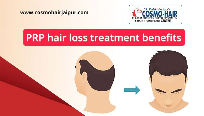 PRP hair loss treatment benefits CosmoHair, Jaipur