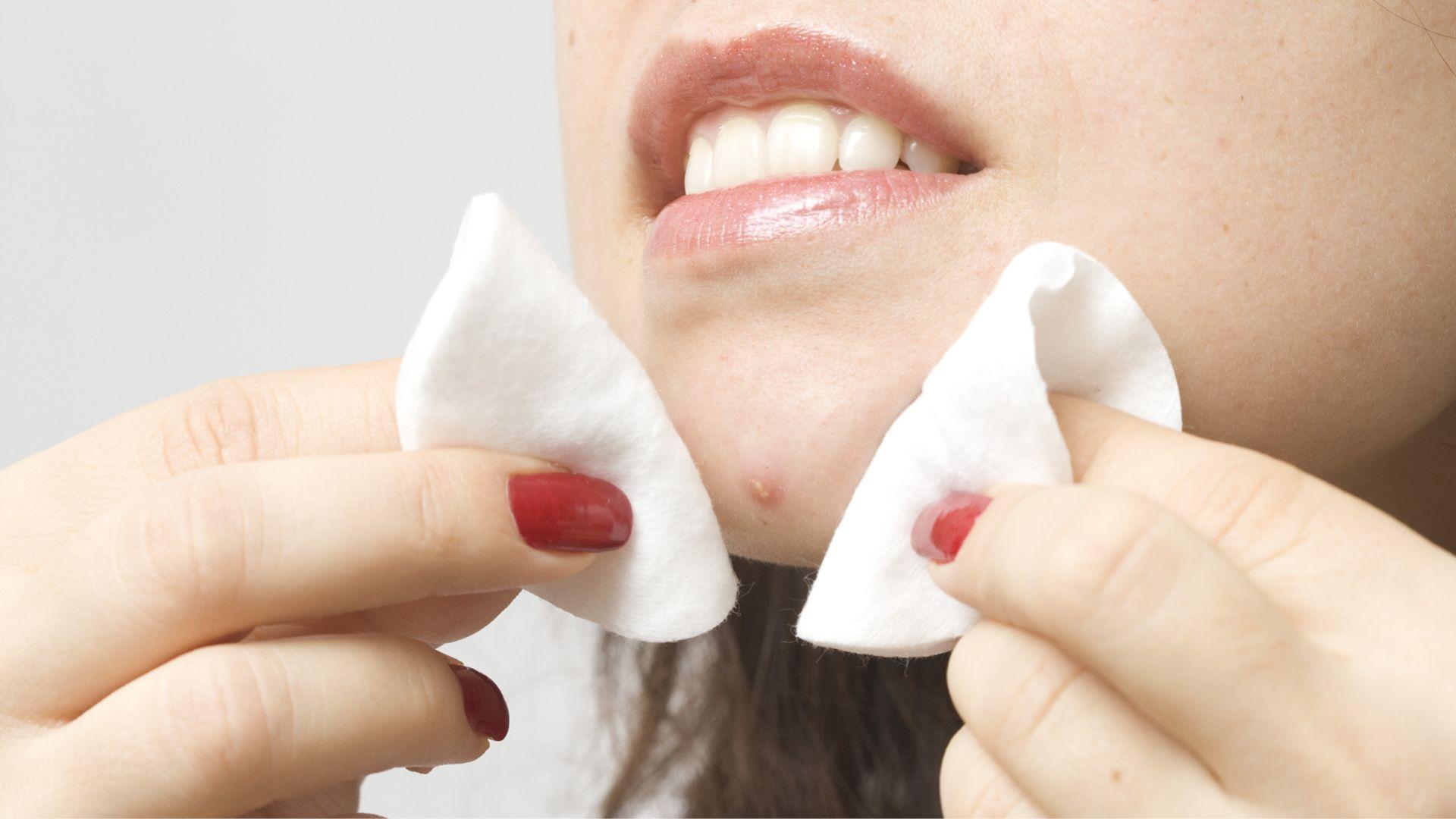 9 Simple Habits To Keep Pimples Away Forever Cosmopolitan Middle East