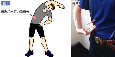 右の腰だけ痛い！筋肉？内臓の病気？原因３つ | 札幌の整体・整骨院【円山公園駅すぐ】札幌円山このは整骨院 運動時の脇腹の痛みの予防法と対処法 | Cramerjapan