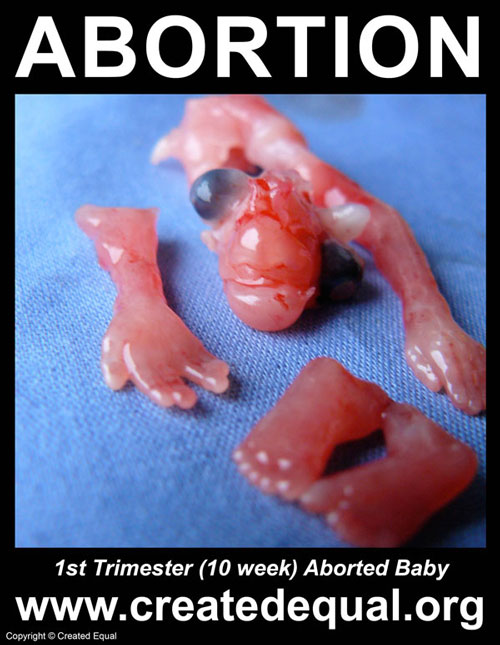 Abortion Signs Exposing the Truth About Abortion Created Equal