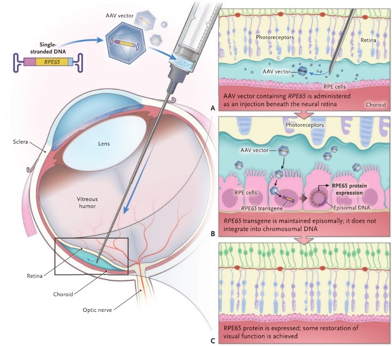 Gene Therapy Creative Diagnostics