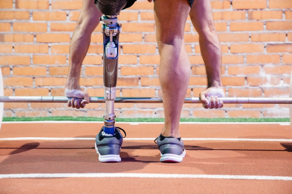 How is Modern Prosthesis Enabling the People, Who Underwent Amputation? Carolina Regional