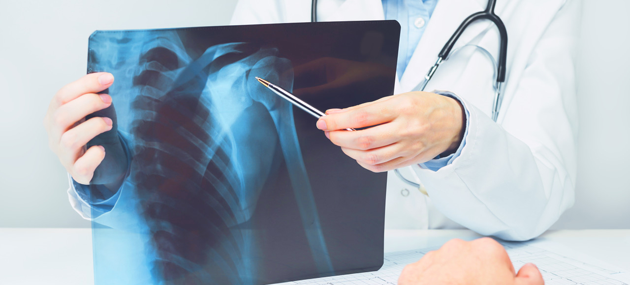 Orthopedic Surgeon X Rays