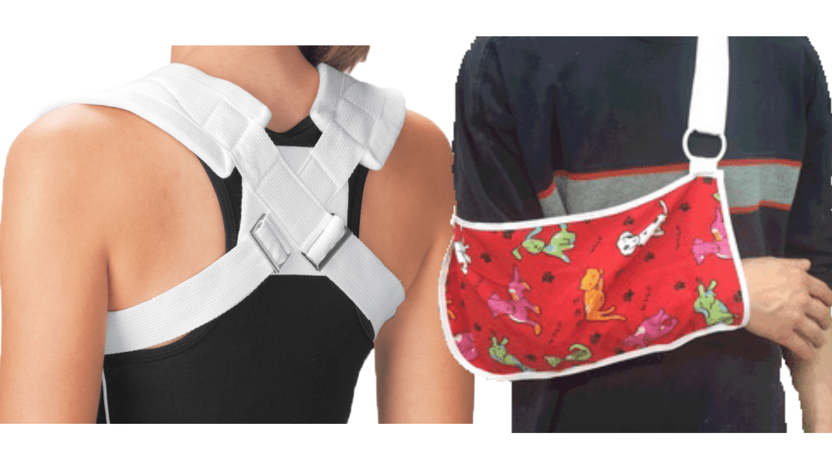 Pediatric Braces CSB Centre Windsor