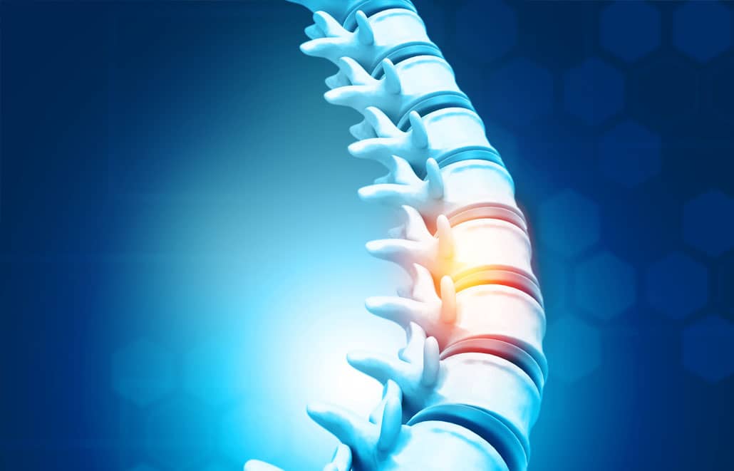 Medical Minute Spine Stimulator Colorado Springs Orthopaedic Group