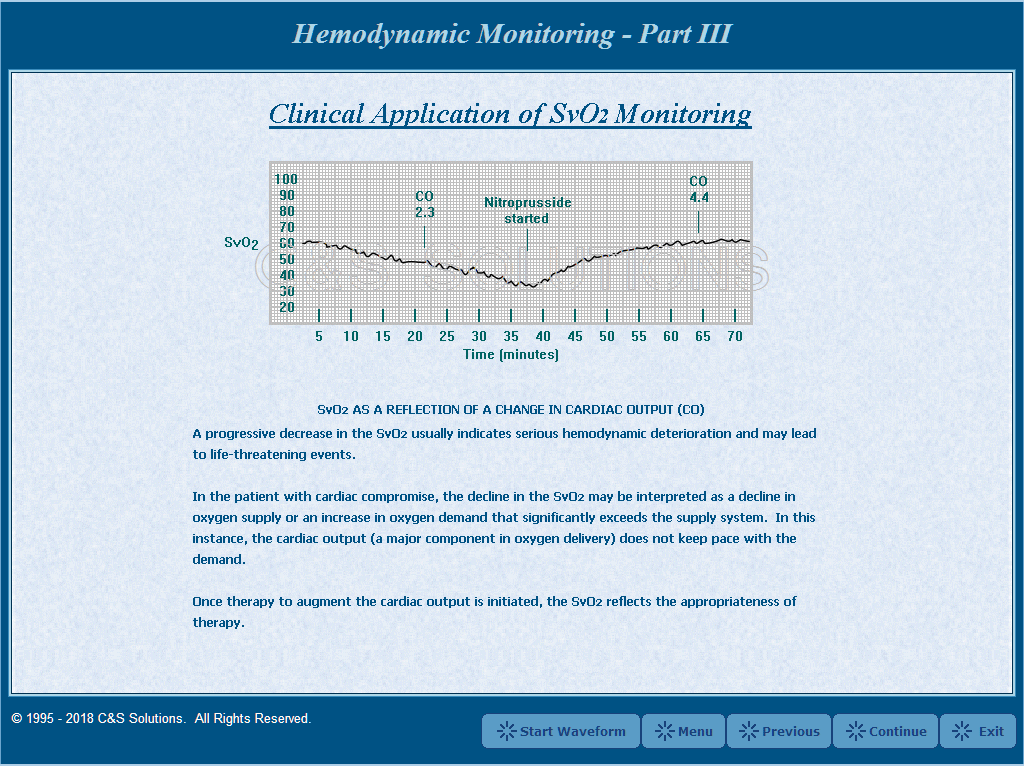 Hemodynamic Monitoring Part III Screen Shots
