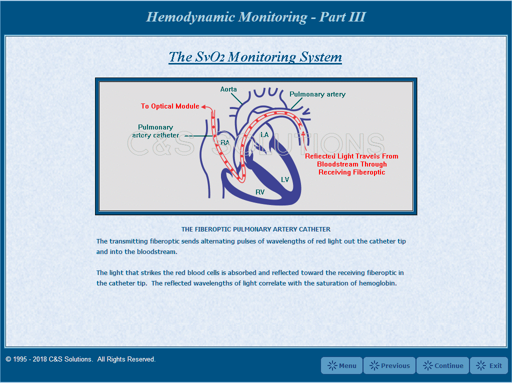 Hemodynamic Monitoring Part III Screen Shots