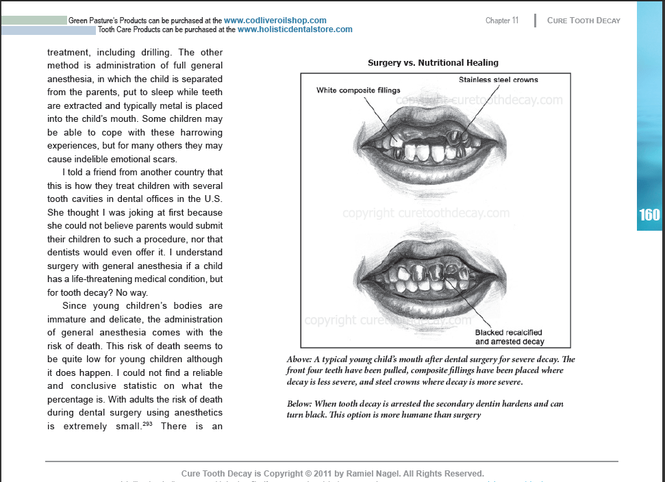 Index of /Cure_Tooth_Decay_img/ebook