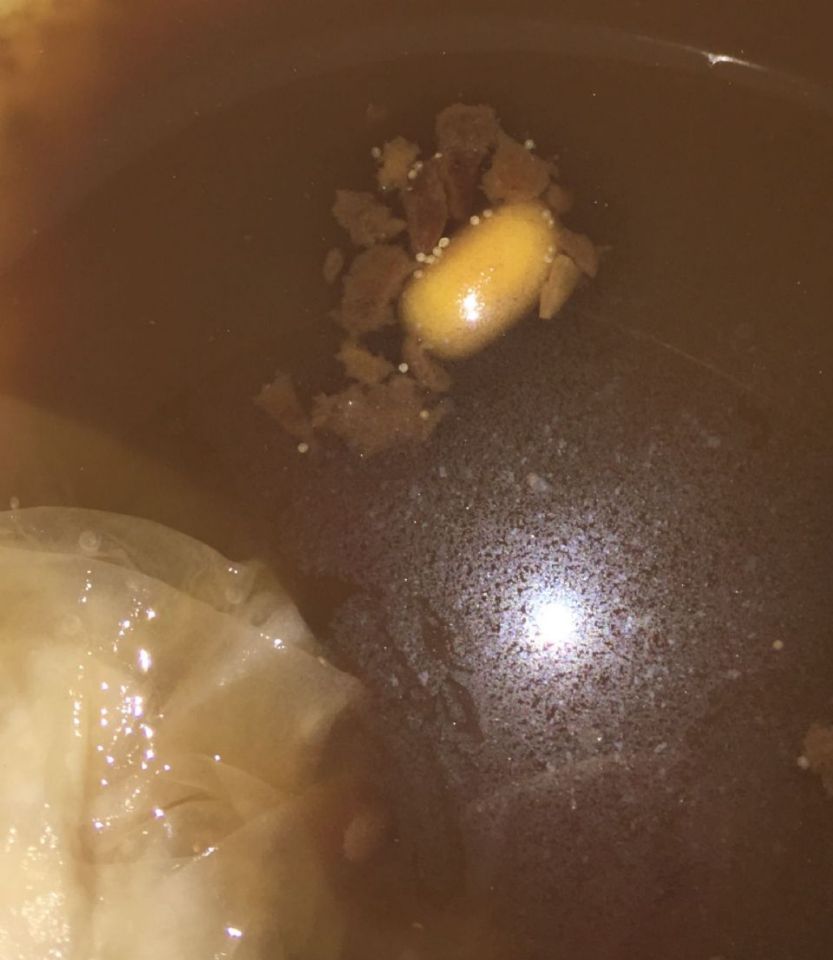 Yellow object in Stool at Ask CureZone Community, topic 2279353