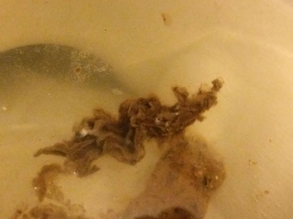 Stringy Mucus In Stool Drone Fest