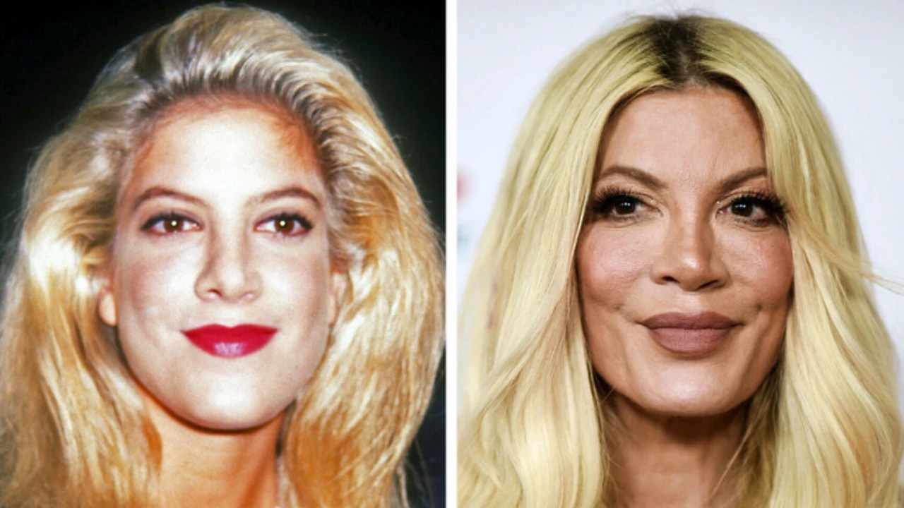 You Won’t Recognize These Famous Stars Anymore Curious World(05)