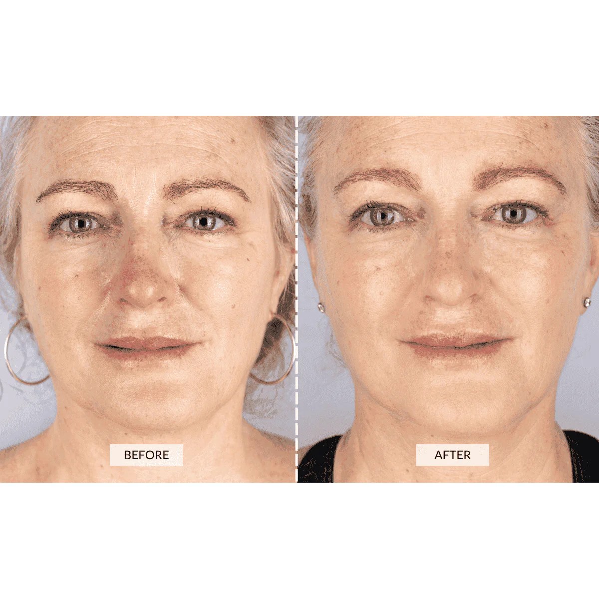 Face Fx Red Light Anti Aging Therapy Reviews Shelly Lighting