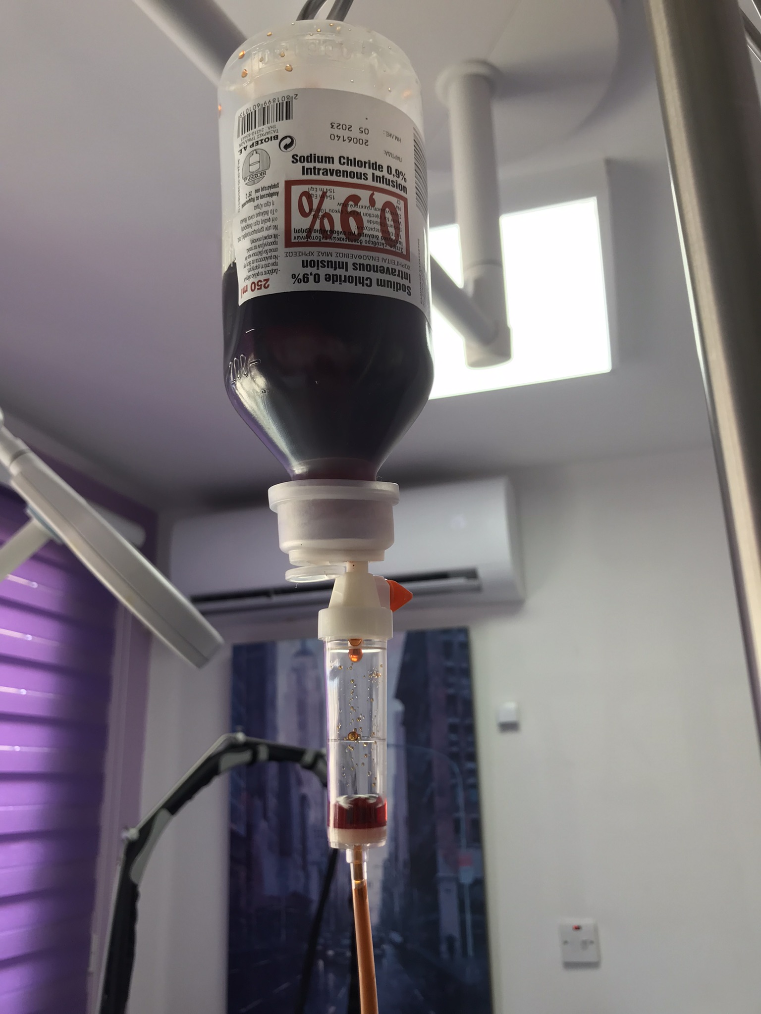 Intravenous iron infusion Cyprus Derma Clinic