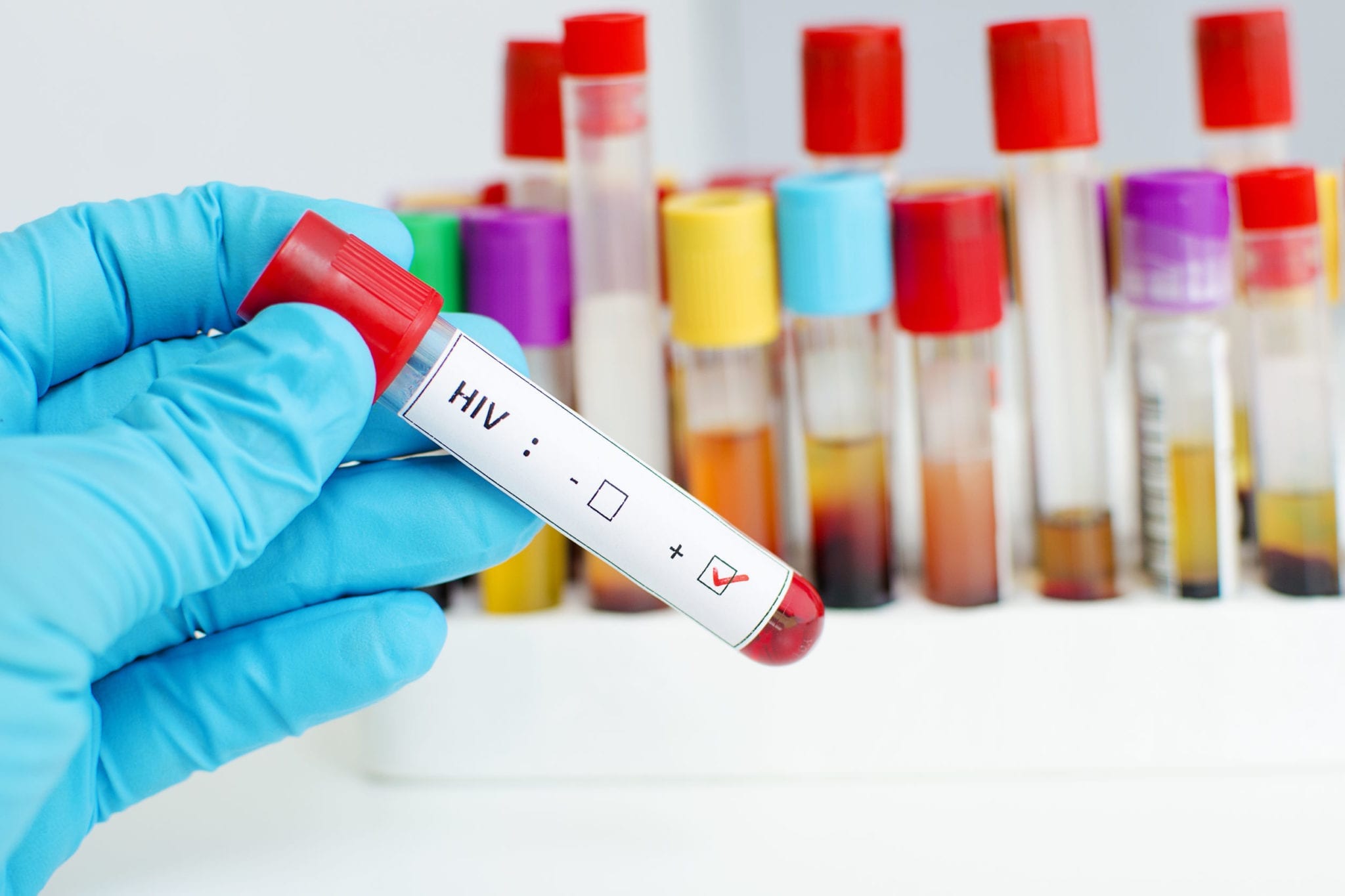 This combination drug can reduce the chances of HIV in
