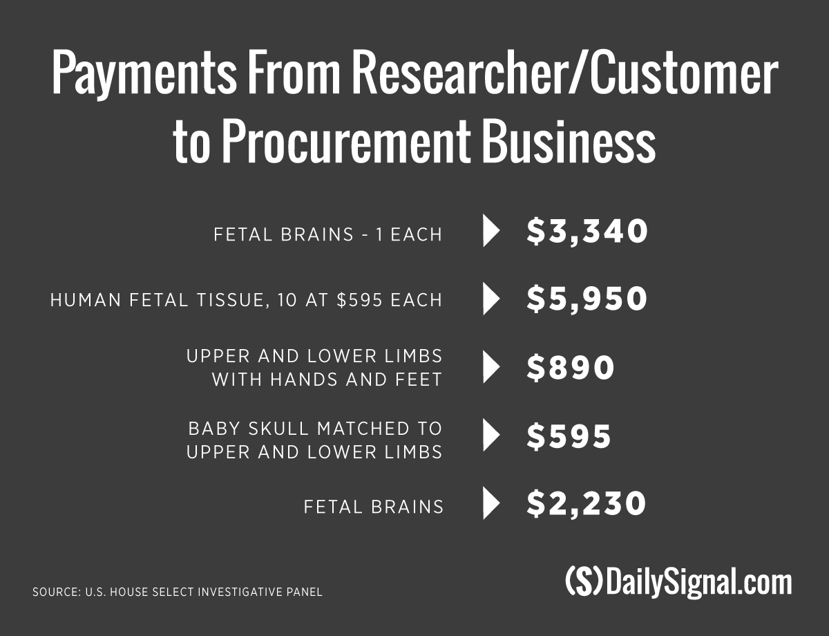 Here’s How Much Baby Body Parts Cost