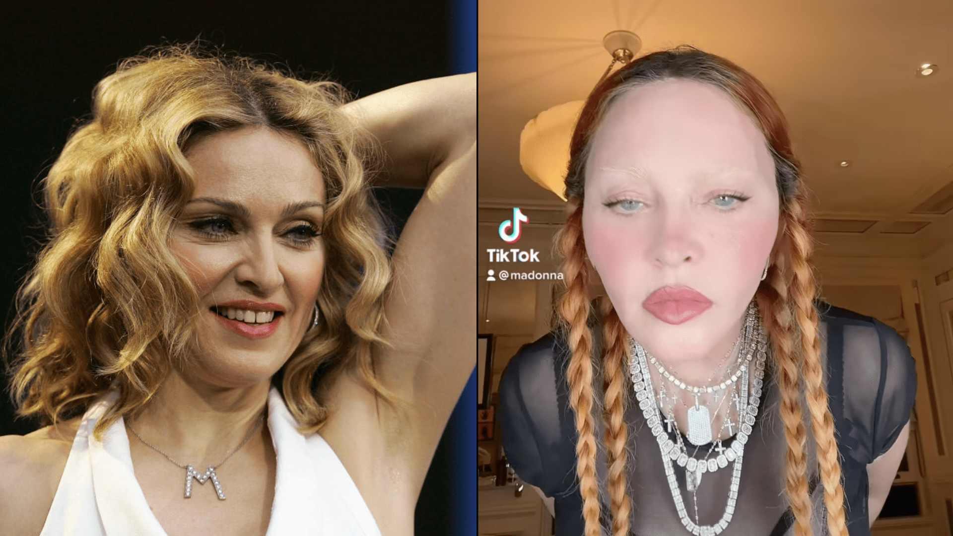 Madonna's Face Then And Now