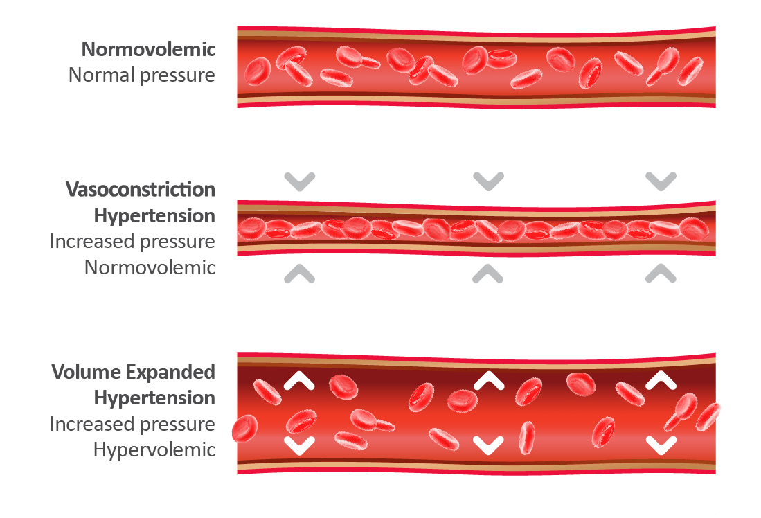 Why is Blood Volume Analysis Important? Daxor