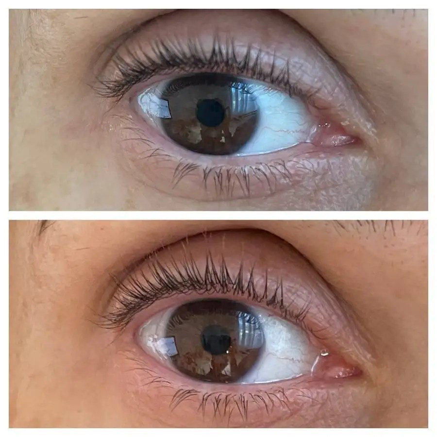 The Ordinary Lash & Brow Serum Reviews & Before & After Photo