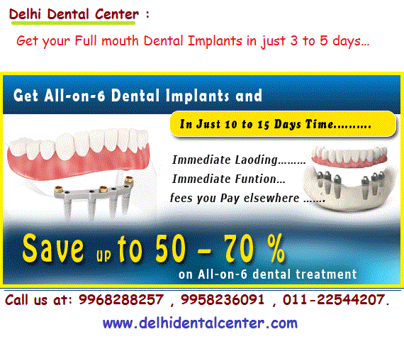 Low Cost Full Mouth treatment in India delhidentalcenter