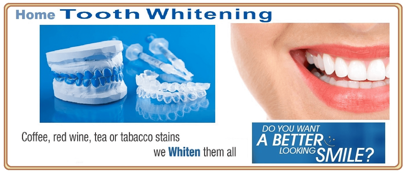 Tooth Whitening treatment Delhi, Laser Teeth Whitening Dentist Delhi
