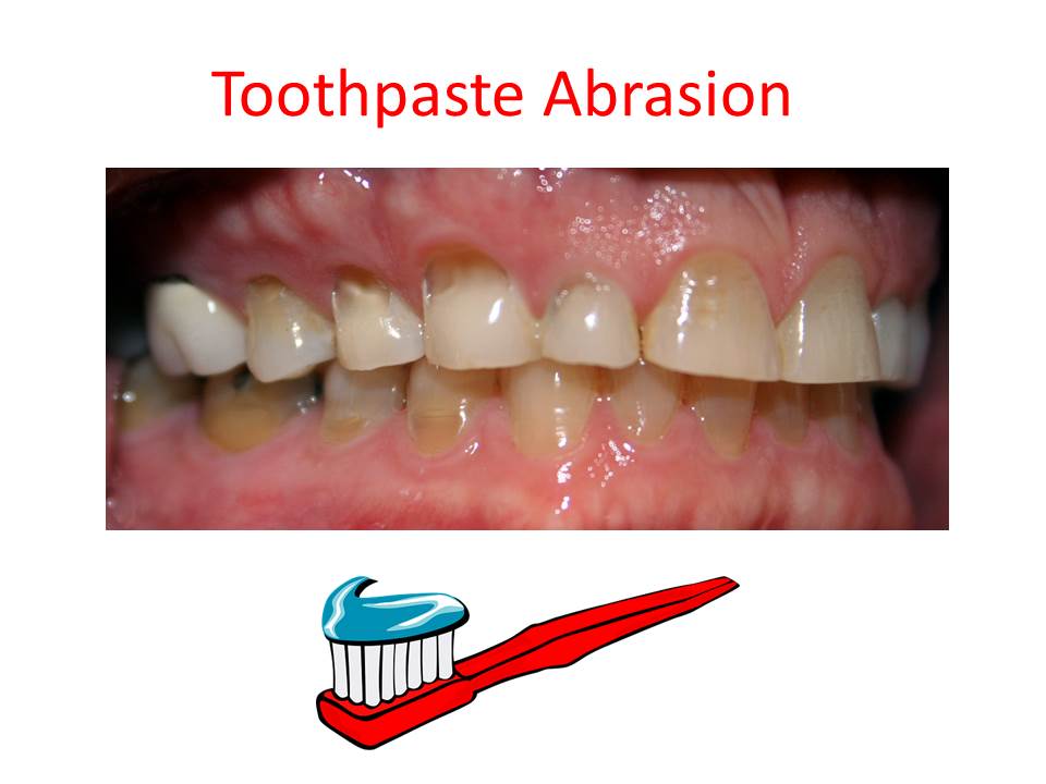 Products That Harm Teeth and Dental Health Salisbury MD