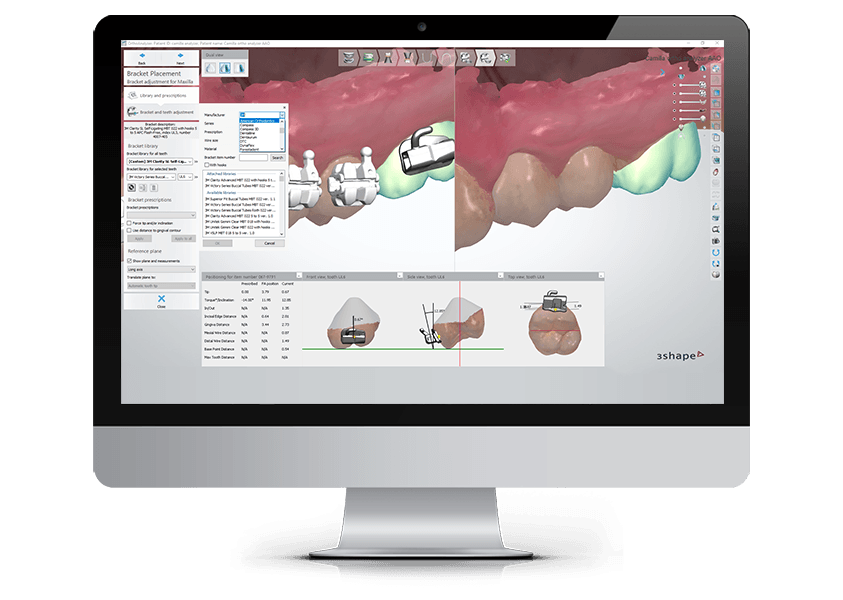 Formations logiciels CFAO 3D dentaire
