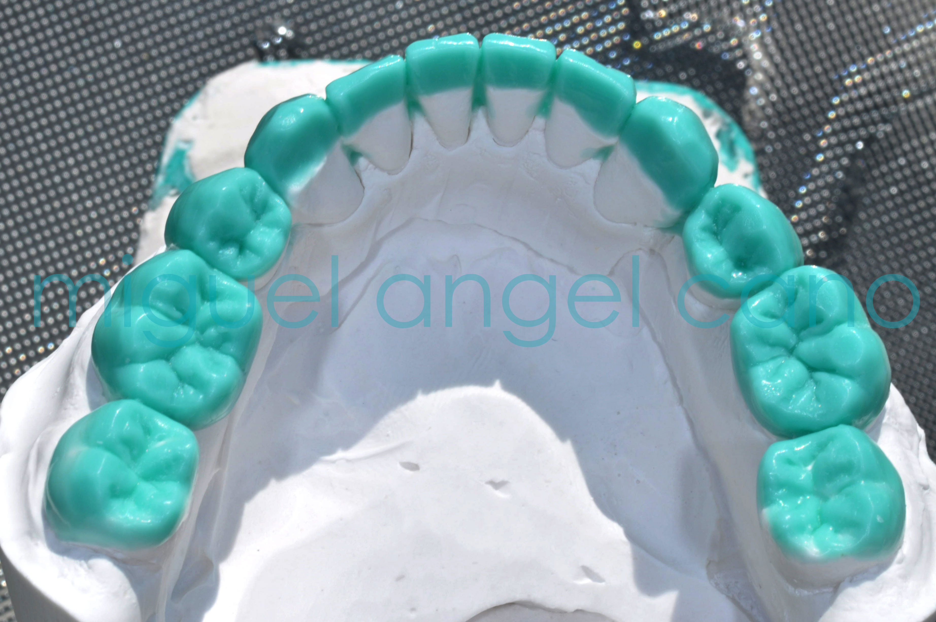 ENCERADO DIAGNOSTICO Dental Cano