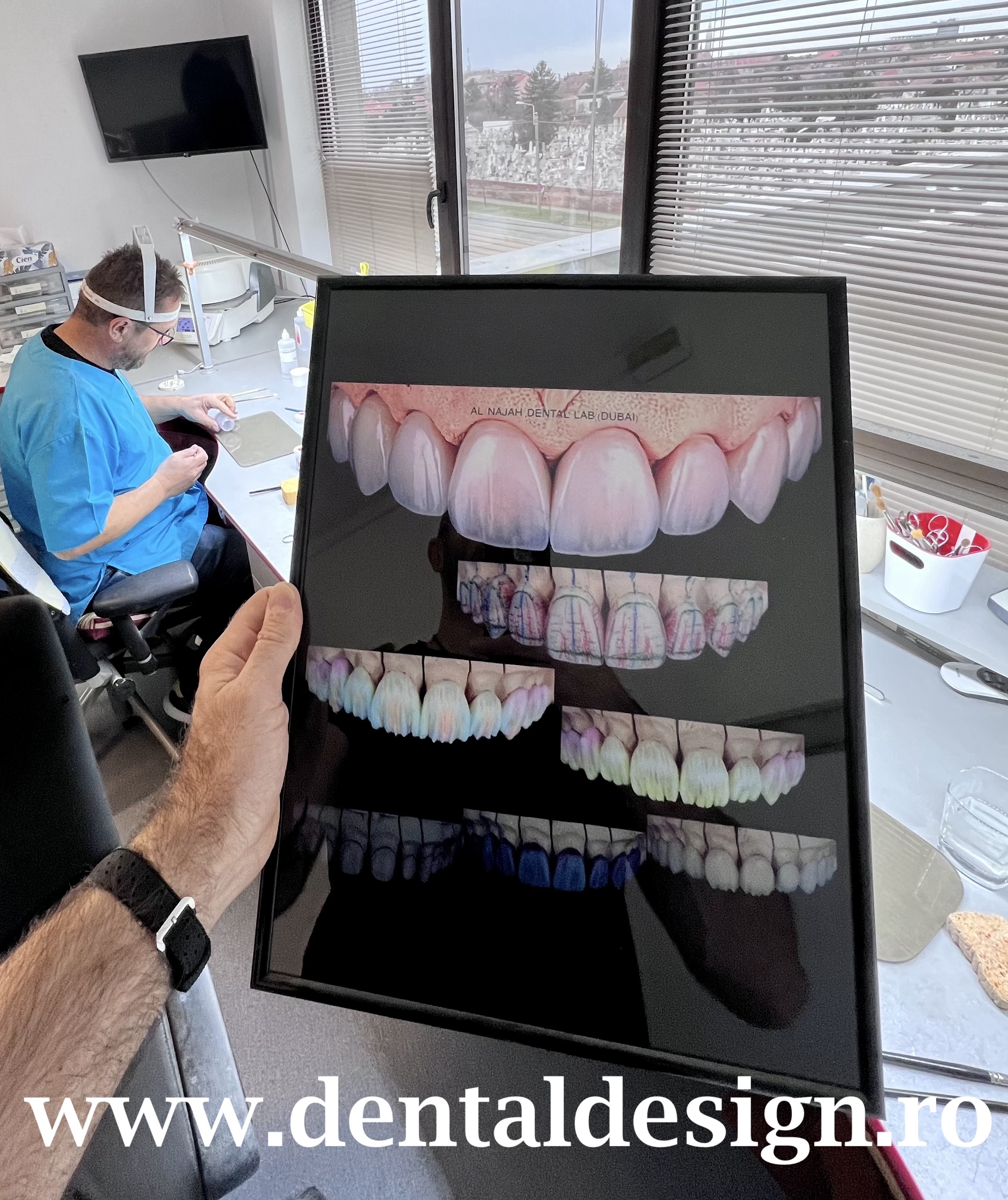 Clinica Stomatologica Timisoara Implanturi Timisoara Dental Design