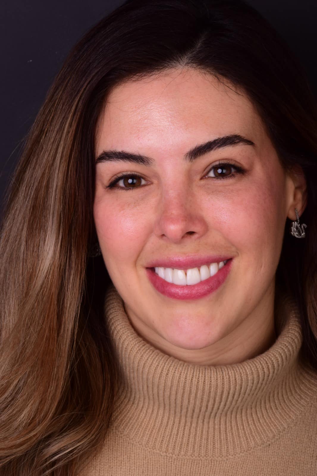 Pacienta Reabilitarea zambetului cu fatete dentare Clinica Dentară