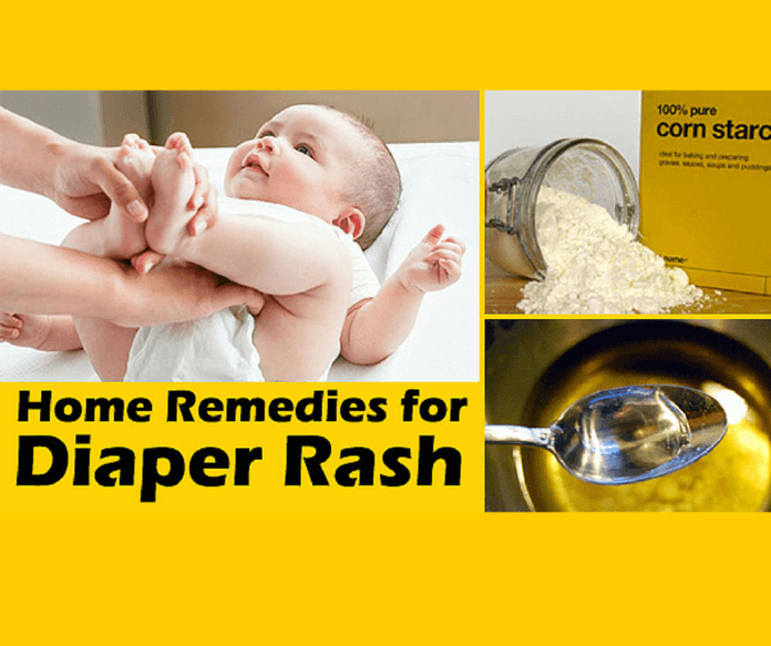 Pure Cornstarch For Diaper Rash Fast The Effective Way Dentgap