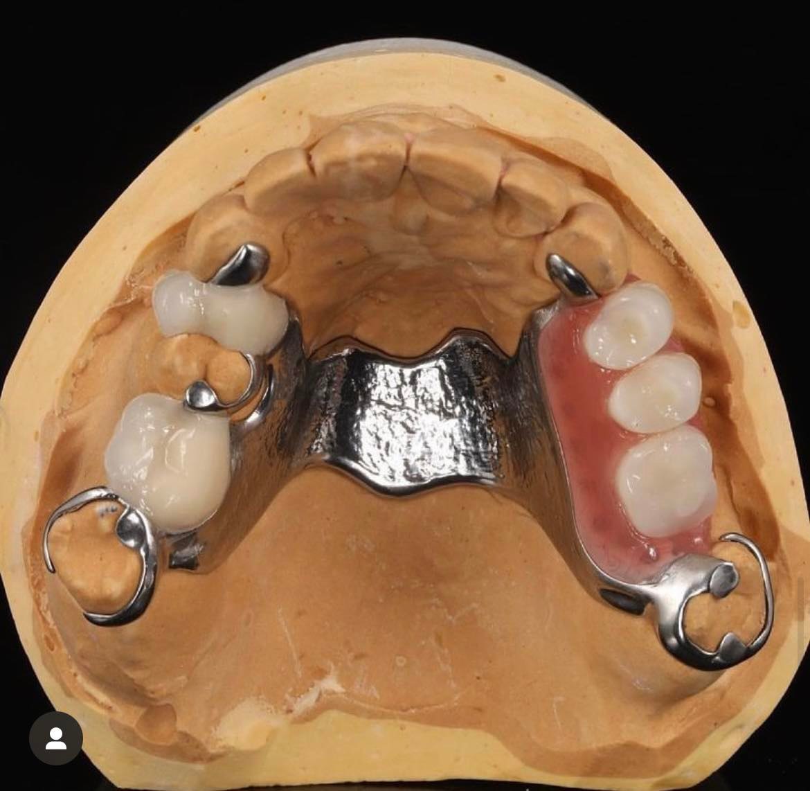 Dentika Solutions Dental laboratory in Bristol, England