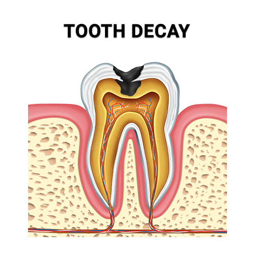 Home Solutions For Toothache Pain Latest News & Reviews Blog Free