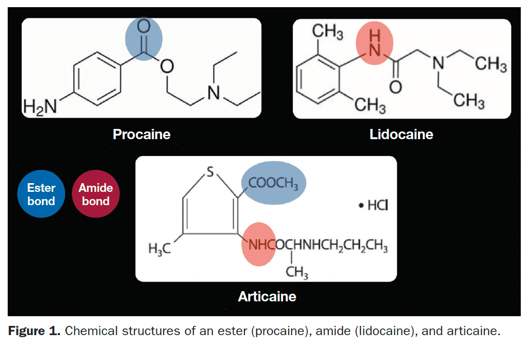 Dental Pain Control and Local Anesthesia A 40Year Journey Dentistry