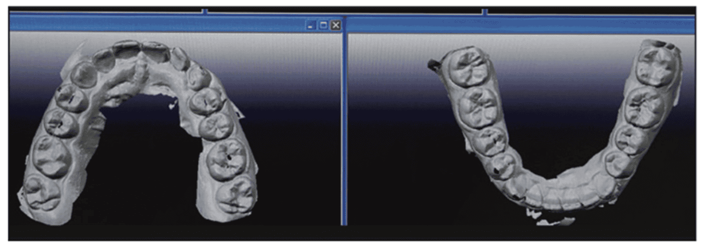 Dental Impressions 1952 to 2022 Balancing the Art, Science, and