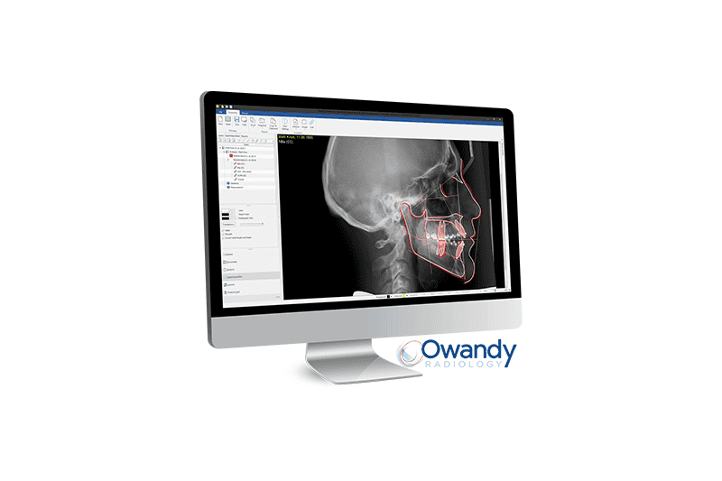 Owandy Launches AIPowered Ceph Analysis Orthodontic Software at CDS '23
