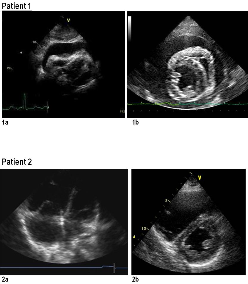 Question 17.2 Deranged Physiology