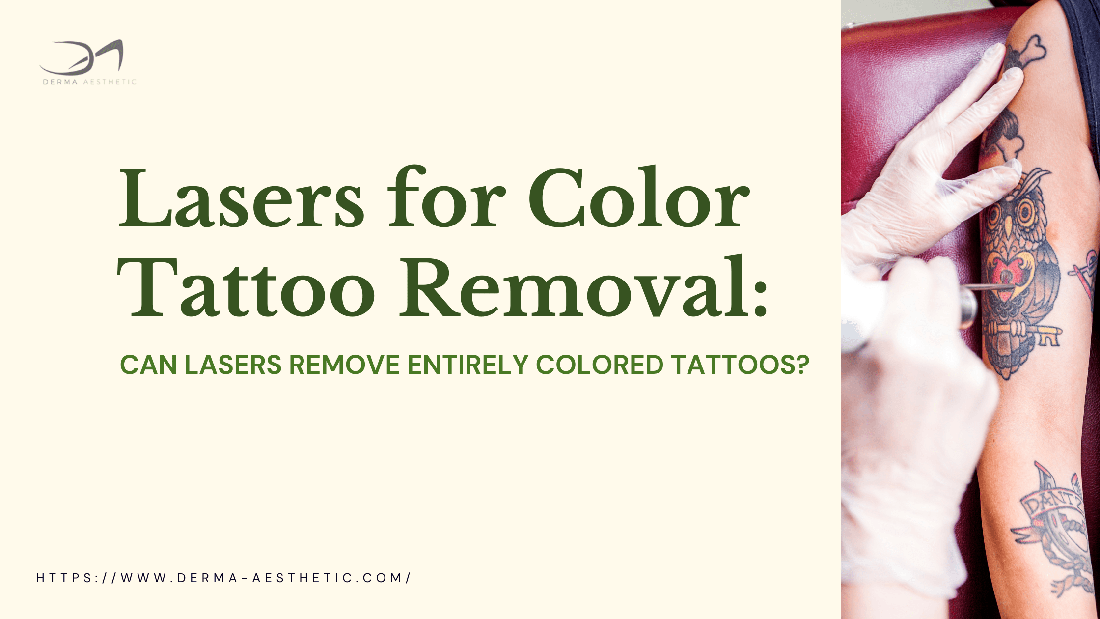 5+ Interesting Facts About Lasers for Color Tattoo Removal Can Lasers