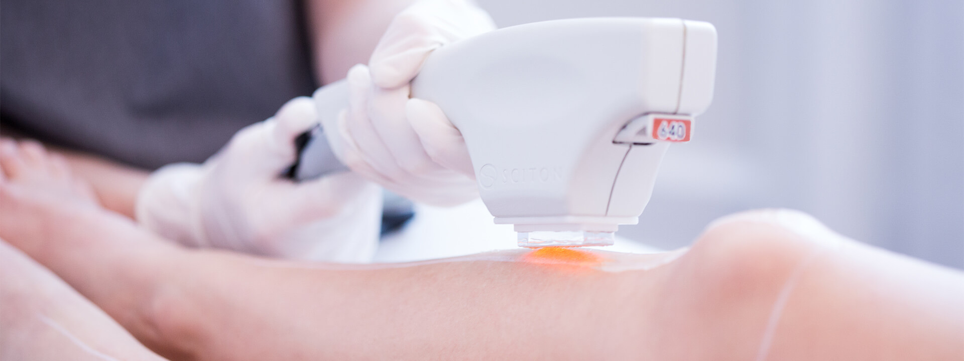 Épilation Definitive au Laser Dermapure